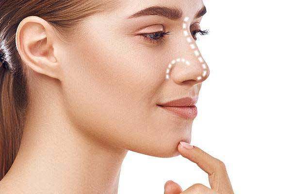 Rhinoplasty